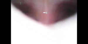 Endoscope Stomach Vore Vid