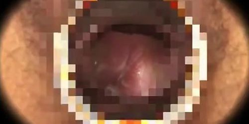 Hidden Spy Medical Movie Only Here