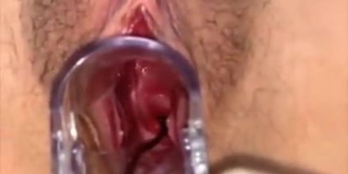 Japanese cervix play 200922