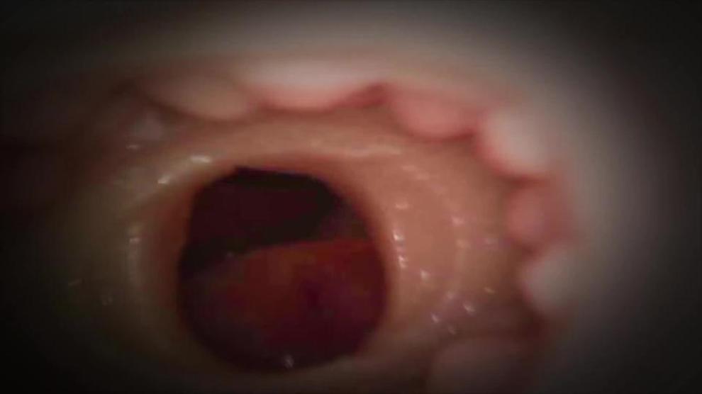 Giant Man POV Cumshot Inside Fleshlight Internal Endoscope Porn Videos