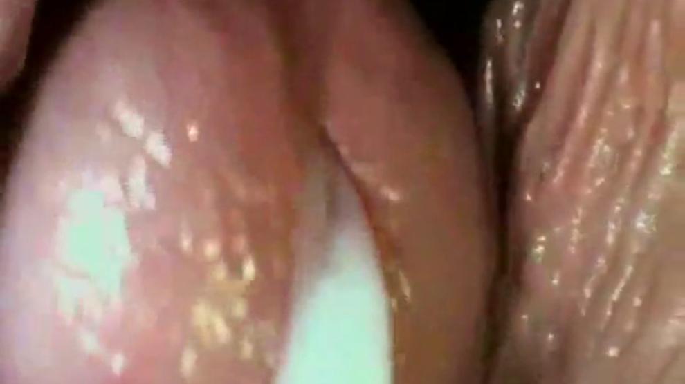 Camera Inside Vagina Str8 Sexual Penetration Porn Videos 9428