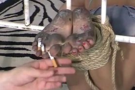 Cigarette foot torture