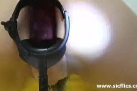 Anal punch fisting and XXL speculum gape