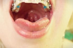 Eating In Braces - Food Fetish - Vore Video - Mouth Tour