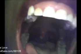 black uvula