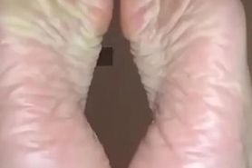 mature feet LTN
