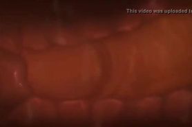 Sex-ed Animatiom - How to inseminate thru cervix