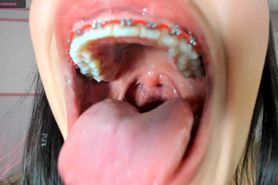 Neraks mouth from inside