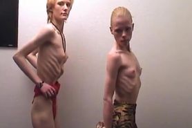 AnorexicLovers - Cindy and Anna