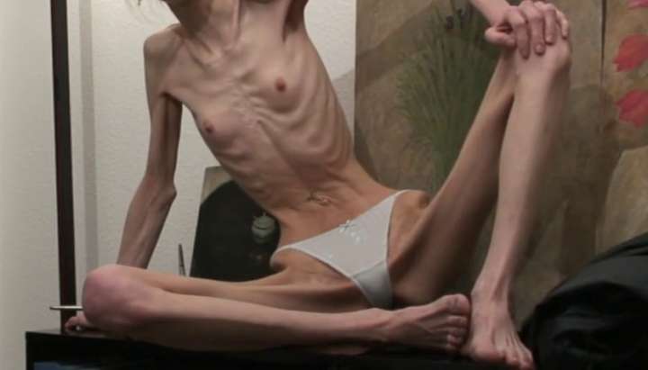 720px x 411px - Anorexic Janine - Showing off Incredible Skinny Lovely Body - Tnaflix.com