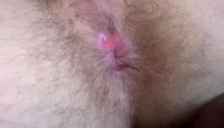 Close Up Asshole - Close up guy pink asshole TNAFlix Porn Videos