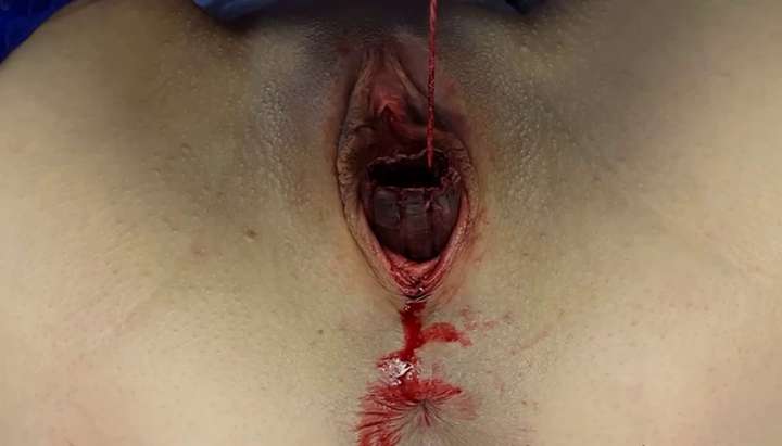 Extreme Lesbian Porn Bleeding - Shit and Menstrual Fetish Slut - Tnaflix.com