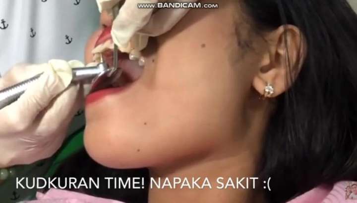 Mouth Dental - Close up view of dental cavity treatment - Tnaflix.com