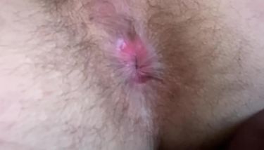 Pink Ass Hole