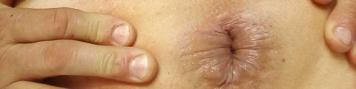 AnalAlain